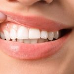 Rahasia Cantik Tersembunyi, Bleaching Gigi dan Klinik Gigi PUTIH Dental