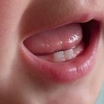 Tips Mudah Merawat Gigi Anak, Obat Sakit Gigi Anak yang Efektif